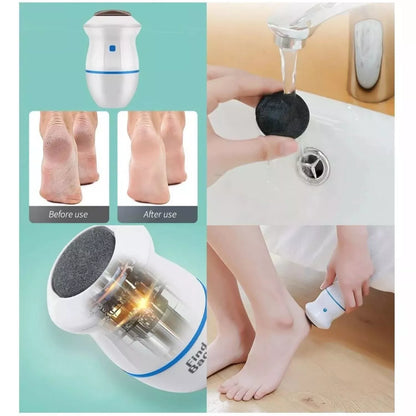 SoftFeet Pro™ – Removedor Eléctrico de Callos